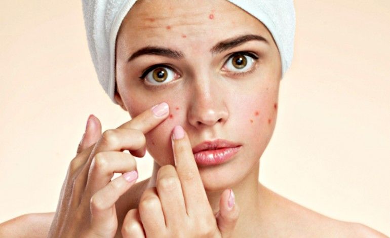 Những Thói Quen Gây Hại Cho Làn Da Khi Ngủ