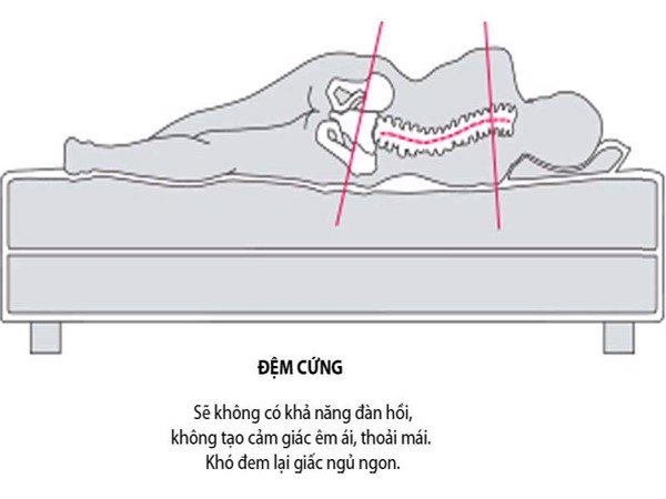 Nên Chọn Loại Nệm Nào Để Bảo Vệ Cột Sống